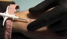 Tehnološka novina u Švedskoj: Čipovima u koži plaćaju račune