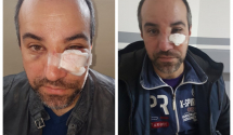 Tomkić preživio traumu, porodica zahvalila građanima na podršci