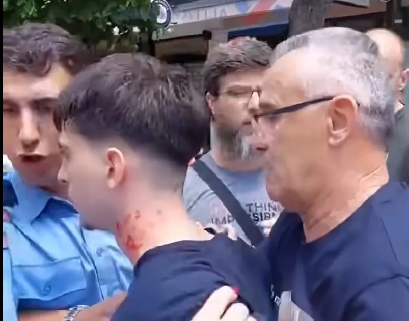 VIDEO Kosovski policajac hvatao za vrat i maltretirao srpskog maturanta u Kosovskoj Mitrovici, spasili ga građani