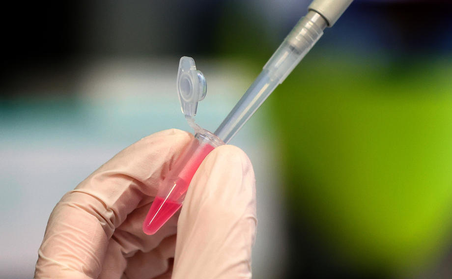 Medicinski tehničar iz Hrvatske koji je imao virus davaće šest mjeseci krv naučnicima