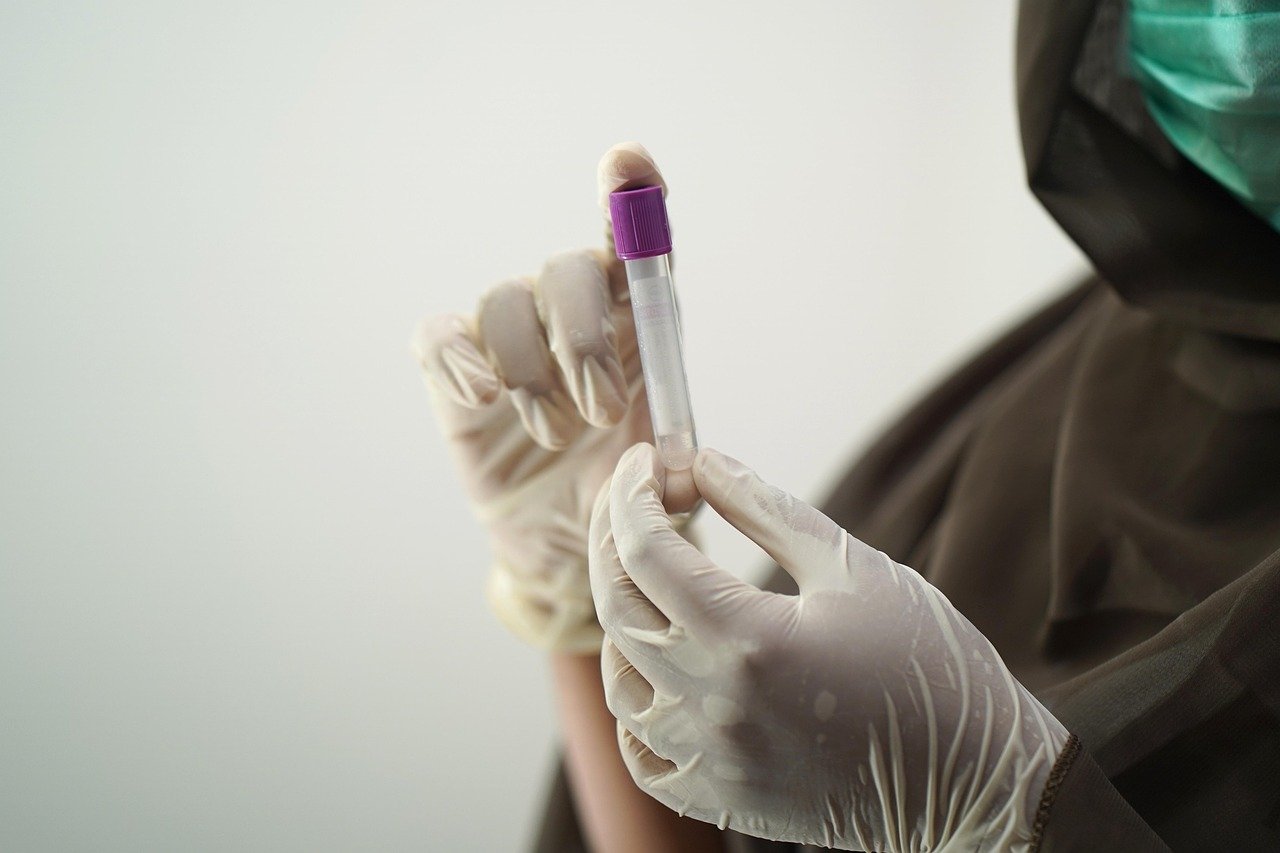 Danas besplatno testiranje na HIV