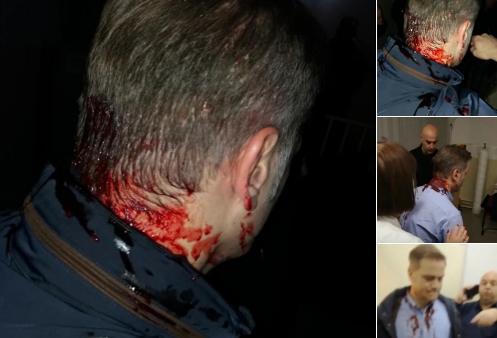 Borku Stefanoviću razbijena glava tokom tribine u Kruševcu