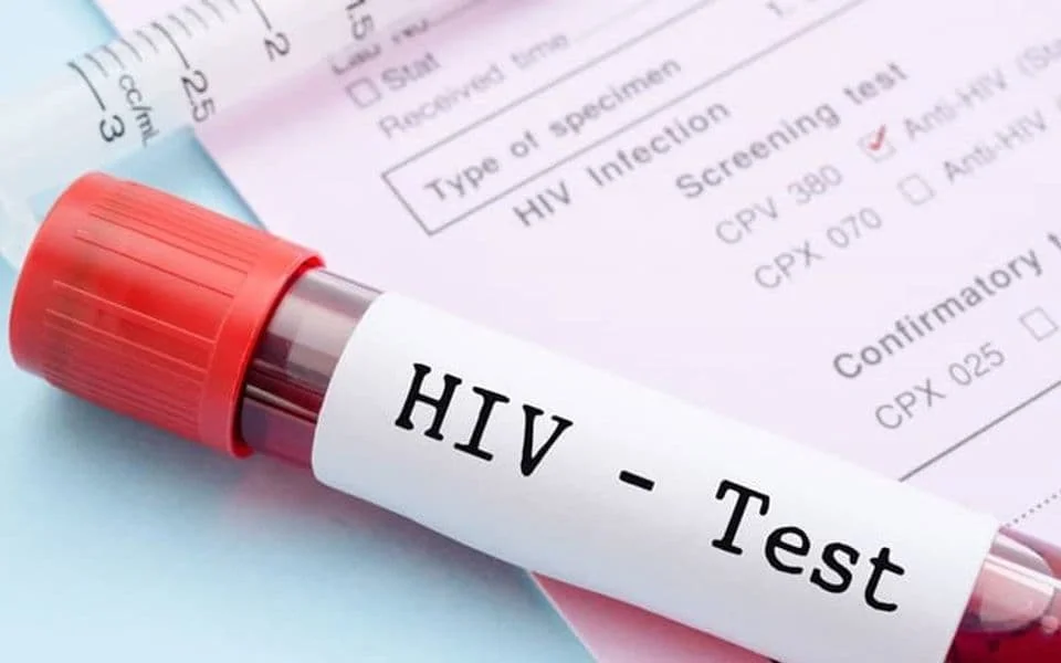 U Crnoj Gori 425 oboljelih od HIV-a