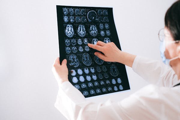 Nervous system and tobacco smoke - toxic effects and how to avoid them?
