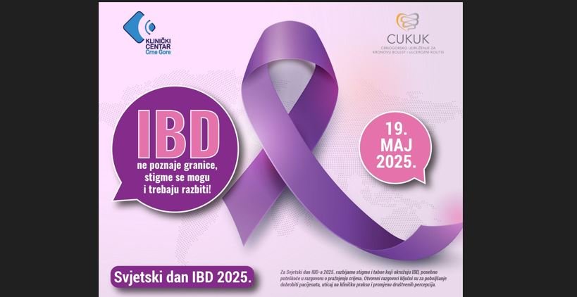 KCCG: IBD ne poznaje granice, stigme se mogu i trebaju razbiti