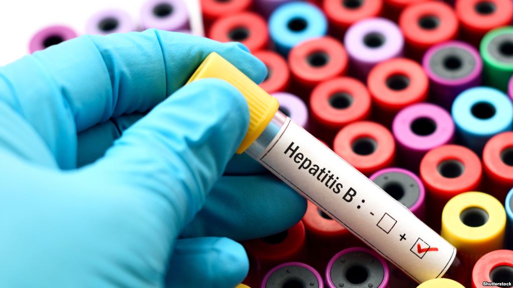 Svakih 30 sekundi jedna osoba u svijetu umre od posljedica hepatitisa