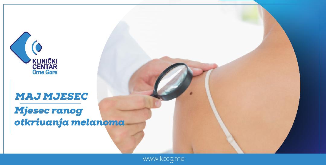 Kampanja ranog otkrivanja melanoma: KCCG organizuje preglede mladeža bez uputa