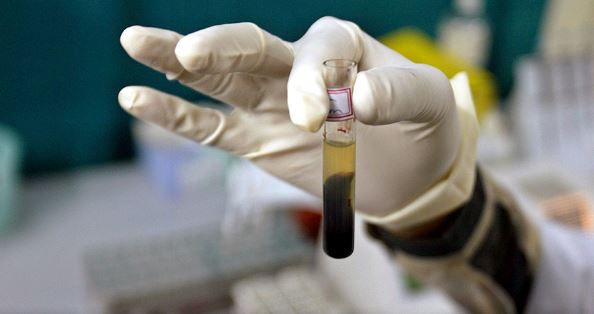 Naučnici otkrili kako da suzbiju HIV virus?