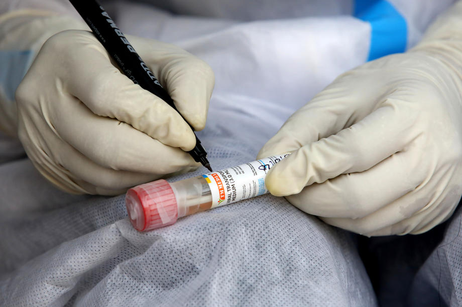 SAD odobrile novi test koji otkriva i grip i koronavirus