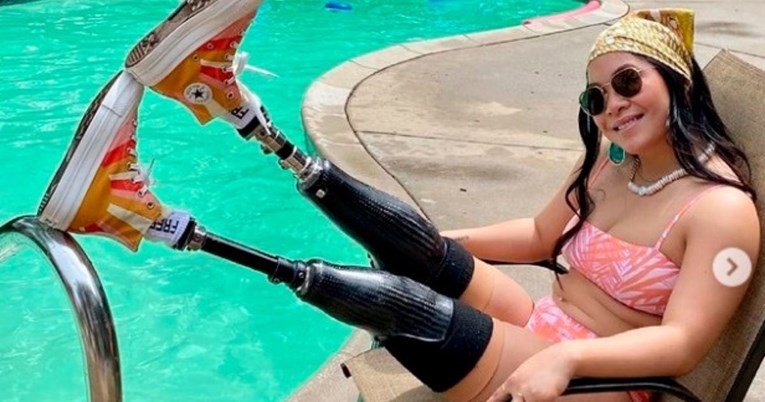 Paraolimpijka i model: Izgubila noge kad su joj se roditelji raznijeli bombom