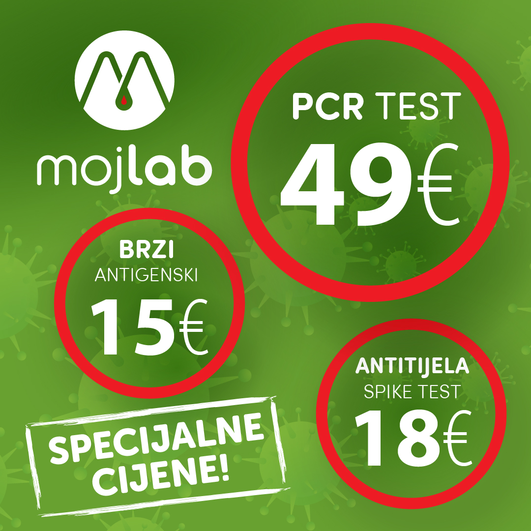 Moj Lab - najsavremenija laboratorija, najniže cijene testiranja