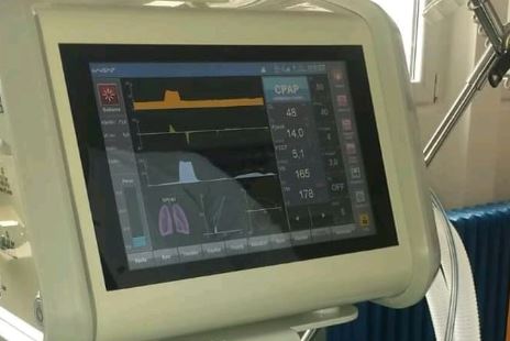 Donacija Savića: U Opštu bolnicu u Bijelom Polju dopremljen respirator