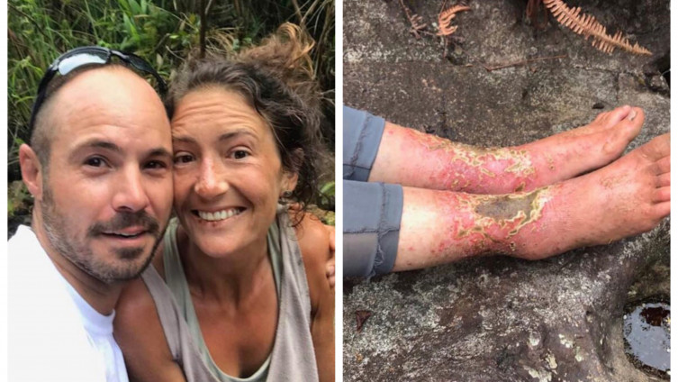Instruktorka joge nestala u gustim šumama: Pronašli je živu nakon 17 dana