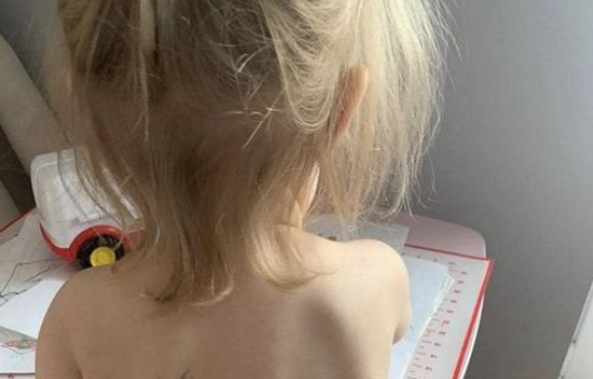 Zašto su djeca iz Ukrajine "tetovirana" na leđima?