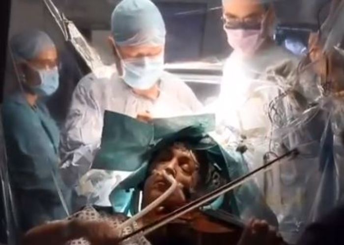 Pacijentkinja svirala violinu tokom operacije na mozgu