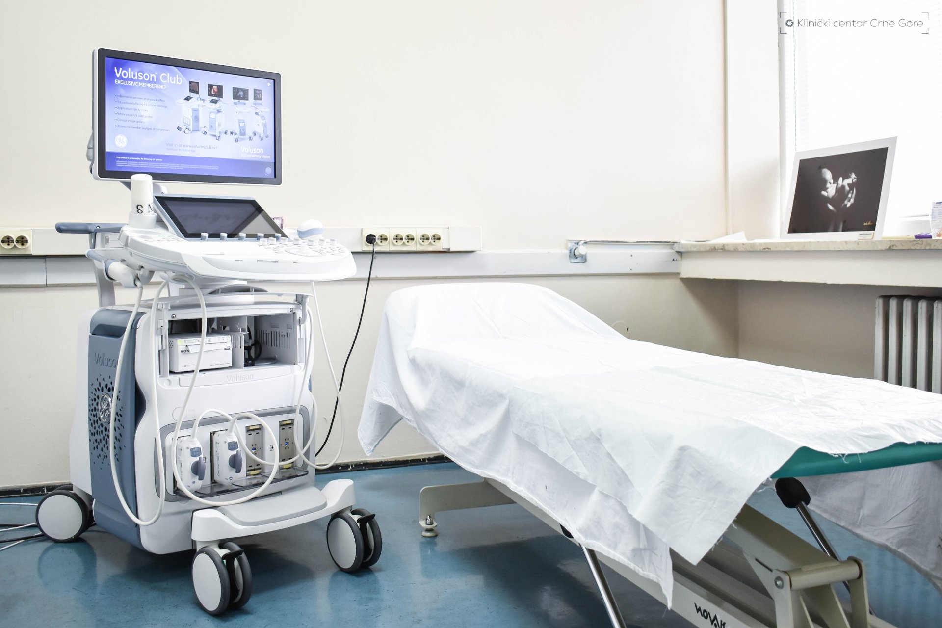 Klinika za ginekologiju dobila najnoviji ultrazvučni aparat