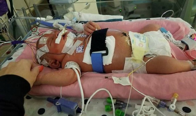 Beba od 18 dana preminula nakon što je poljubio neko ko je imao herpes