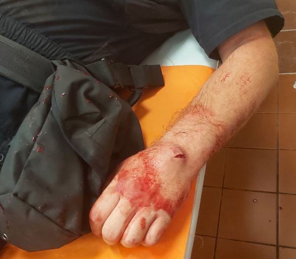 Šuškavčević: Za tri mjeseca napadnuto 178 policajaca